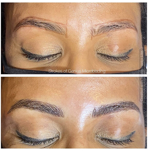 Eastern Awakening Hilsen Saline Tattoo Removal: Healing Timeline and Aftercare Procedure - Strokes  of Genius Microblading