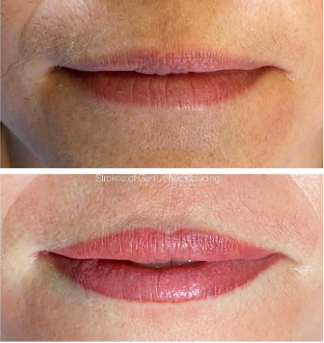 How Long Does Permanent Lip Blushing Lasts?