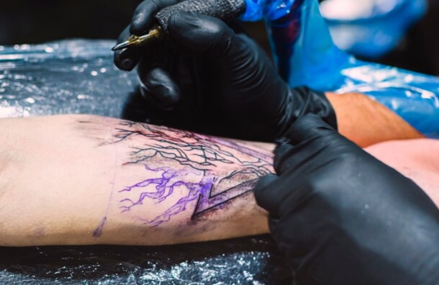 What Are the Benefits of Saline Tattoo Removal in Orlando?