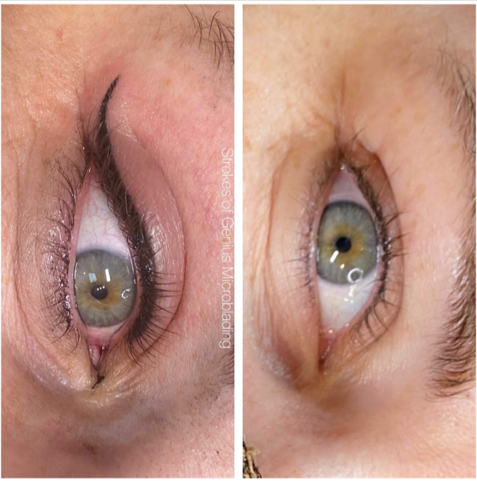 What to Know Before Getting Eyeliner Tattoo in Windermere?