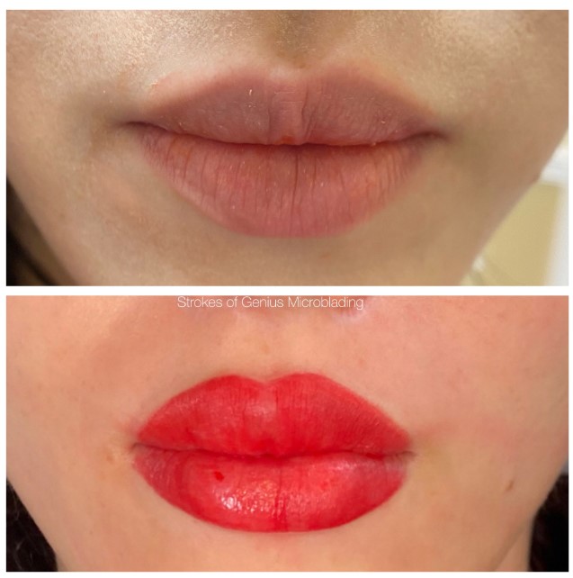 Dark Lip Correction, Neutralization and Lip Blushing: What’s the Difference