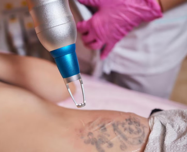 Best Tattoo Removal in Windermere, FL | Strokes of Genius Microblading